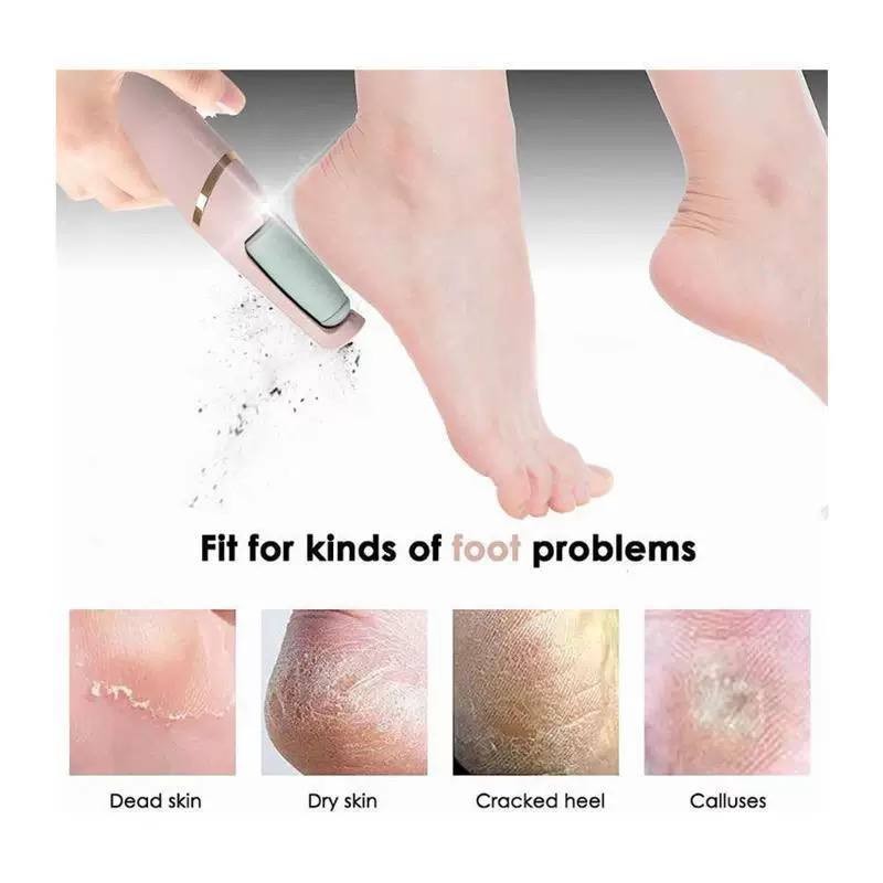 مبرد قدم شحن وشييين نعومه وتقشييير